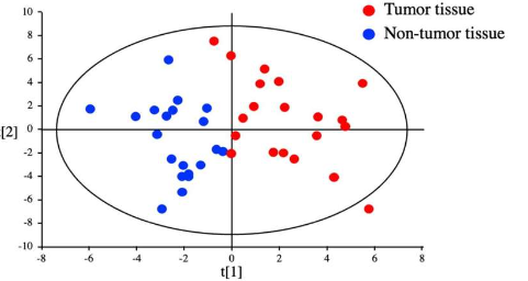 研究人员使用代谢组学发现肝细胞癌的潜在生物标志物