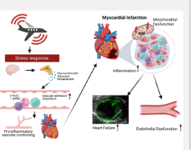 飞机噪音会增加心肌梗塞的损害