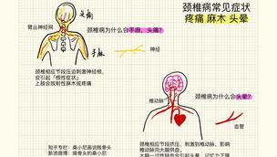 颈椎病会引起头晕恶心吗？ 怎么判断是不是颈椎病引起的头晕