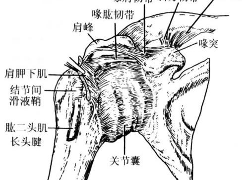 小针刀治疗肩周炎好吗？ 肩周炎的特征