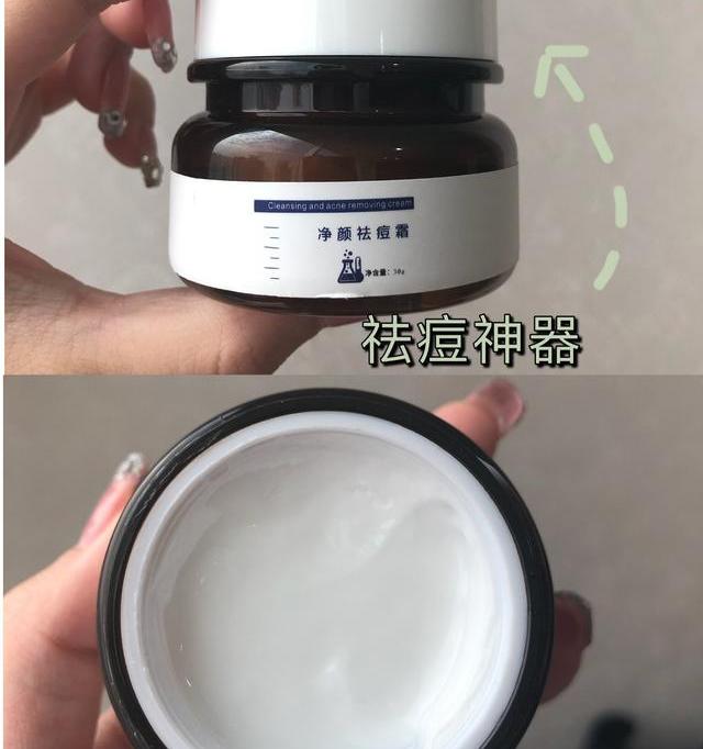 脸上各个部位长痘痘的原因？ 脸上长痘痘分布原因图