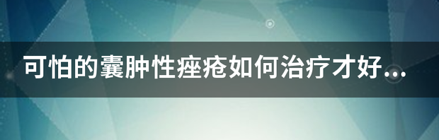 我是油性皮肤，出现了痤疮，怎么治疗好？ 严重痤疮怎样治疗