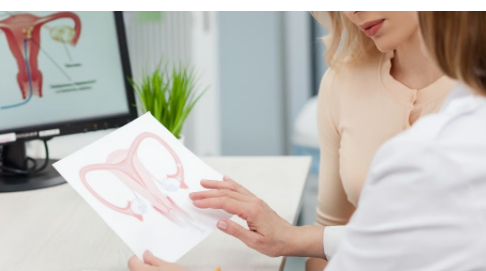 很少有子宫肌瘤女性能接受微创治疗